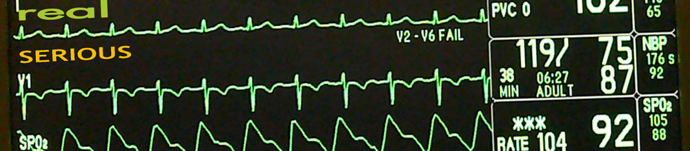 heart rate, blood pressure, average, oxygen sensor on electronic monitor image jeff buster