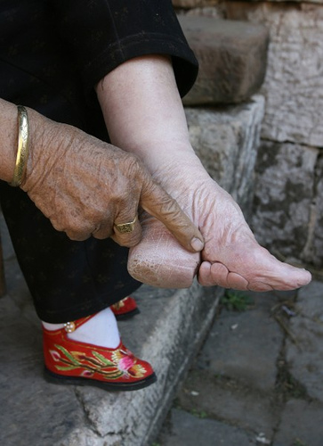 Footbinging